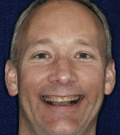 Figure 3  Computer imaging was used to facilitate smile design.