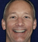 Figure 4  Computer imaging was used to facilitate smile design.