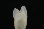 Fig 1b. As seen in cross-sections of teeth, maintaining a true cusp-to-fossa relationship is not always the norm.