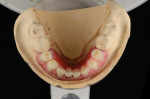 Fig 25. An occlusal view of the wax try-in.
