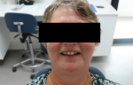 Fig 3. A portrait image of the patient’s natural dentition, which she wanted the denture to resemble closely.