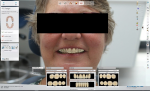 Fig 12. Digital software is used to design the restorations, incorporating a photo of the patient to match the design to her natural dentition.
