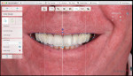 Fig 4. Digital smile design.