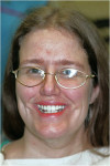 Figure 12  Facial view, patient after treatment.