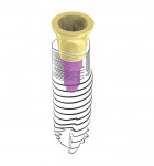 Fig 7. Connect extension abutment. This 4 mm diameter solid transmucosal abutment, in various heights, allows for rotation-free or anti-rotation suprastructure connection.
