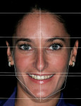 Figure 1  The frontal framework was based on facial analysis involving the horizontal plane, vertical plane, the relationship of thirds, and strong side versus weak side.