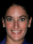 Figure 2  Vertical and horizontal plane making up the facial 
