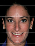 Figure 6  Face divided into thirds to evaluate abnormalities.