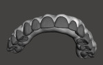 Fig 4. STL image of the teeth section nested into the denture base section.