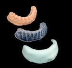 Fig 17. Printed original denture (top), flexible vacuform (middle), and PVS index (bottom).