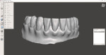 Fig 15. Screenshot of the STL of the monoblock complete denture.