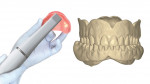 Denture digitization using an intraoral scanner (CS 3700, Carestream Dental) and the digital rendering created.