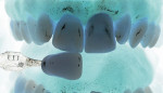 Figure 5  With one good value image, with photo-editing software one can gather much more information. One can now check the value by converting to black and white, contrast the teeth to bring out the color to see what ceramic effects can be layered