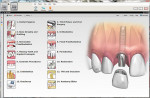 Figure 5  Consult-PRO™ Dental Patient Education Software 2011 provides detailed information from every dental specialty, from general dentistry, implants, oral surgery, periodontics, orthodontics, and endodontics.