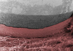 Figure 2  High-magnification SEM showing connective tissue attachment to the abutment margin.<sup>1</sup>