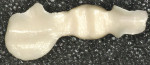 Figure 7  Occlusal view of the Cercon framework.