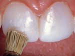 Figure 17  To achieve a life-like final luster, polishing points and brushes were used.