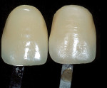 Figure 2: Image of two of the same shade guides with different surface texture. Notice the one with different texture is perceived as a different color.